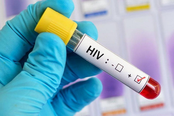 The process of medical examination for HIV infection of persons entering into marriage to be electronicized