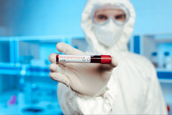 Ministry of Health: 124 new cases of coronavirus detected in Uzbekistan