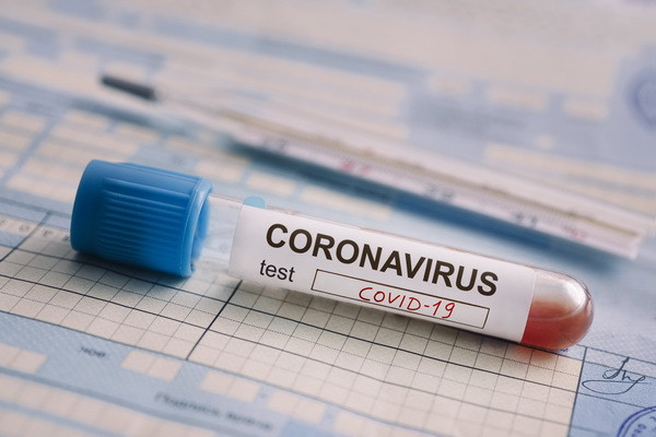 Patent for coronavirus drug issued in Uzbekistan