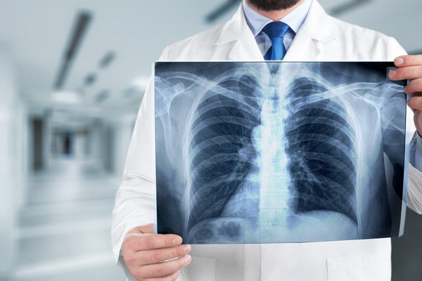 Phthisiopulmonology departments are being created as part of the central polyclinics