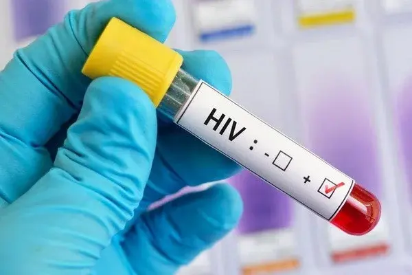 The process of medical examination for HIV infection of persons entering into marriage to be electronicized