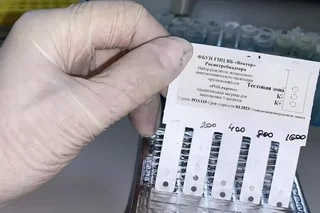Russia hands over tests for monkeypox to Uzbekistan