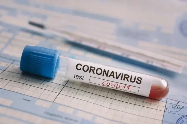 Patent for coronavirus drug issued in Uzbekistan