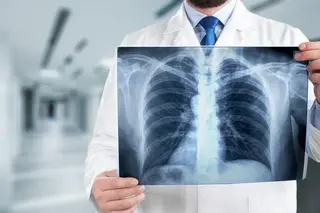 Phthisiopulmonology departments are being created as part of the central polyclinics