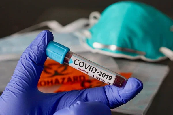 WHO: over the past day, 11 335 patients with a diagnosis of COVID-19 died in the world