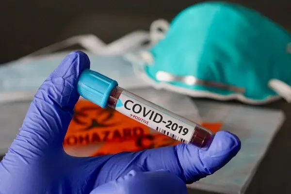ВОЗ: за последние сутки в мире умерло 11 335 больных с диагнозом COVID-19